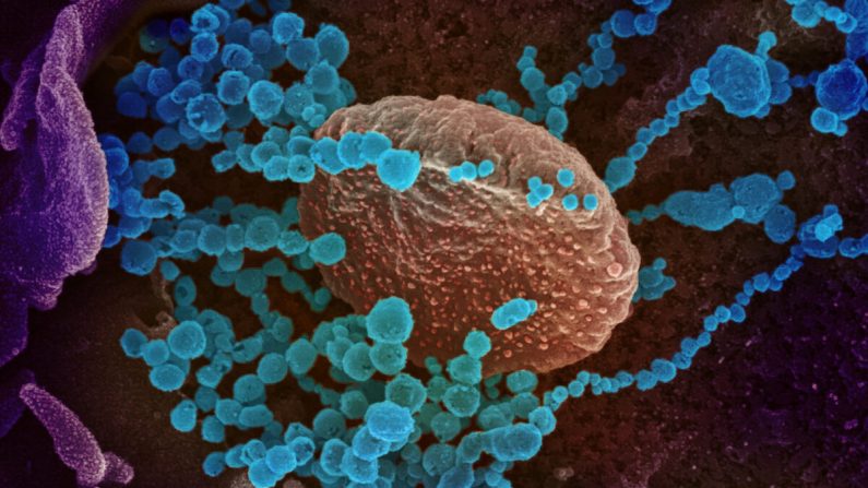 La imagen del microscopio electrónico de barrido muestra al virus del PCCh (objetos redondos azules), el virus que causa COVID-19, que emerge de la superficie de las células cultivadas en el laboratorio. (NIAID-RML)
