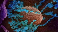 El COVID-19 puede causar que el sistema inmunológico de pacientes ataque sus propias células: estudio