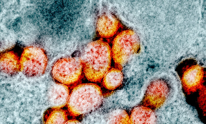 Microfotografía de transmisión de partículas del virus SARS-CoV-2, aislada de un paciente. Imagen capturada y coloreada en la Instalación de Investigación Integrada del NIAID (IRF) en Fort Detrick, Md. (NIAID)