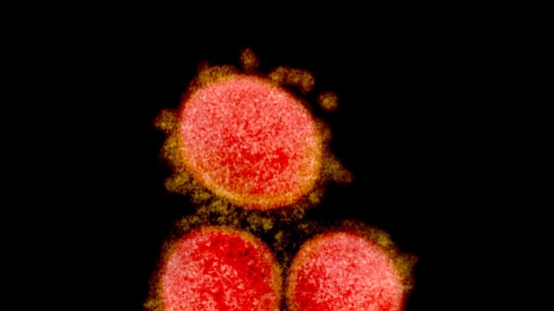 Micrografía electrónica de transmisión del virus CCP, comúnmente conocido como nuevo coronavirus o SARS-CoV-2, aislado de un paciente. Foto publicada el 10 de marzo de 2020. (NIAID)
