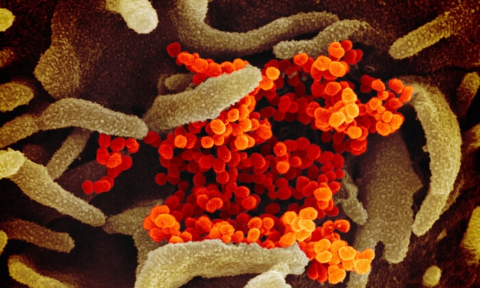 Esta imagen de microscopio electrónico de barrido muestra el nuevo coronavirus (naranja), que causa la enfermedad COVID-19, aislado de un paciente en los EE.UU., emergiendo de la superficie de las células (verde) cultivadas en el laboratorio. (NIAID-RML)