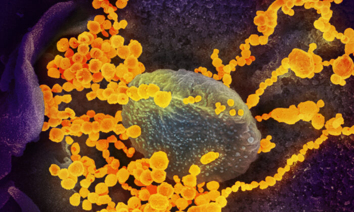 Esta imagen de microscopio electrónico de barrido muestra el virus SARS-CoV-2 (objetos redondos amarillentos), al que The Epoch Times se refiere como el virus del PCCh, emergiendo de la superficie de células cultivadas en laboratorio. Foto publicada el 19 de febrero de 2020. (NIAID-RML)