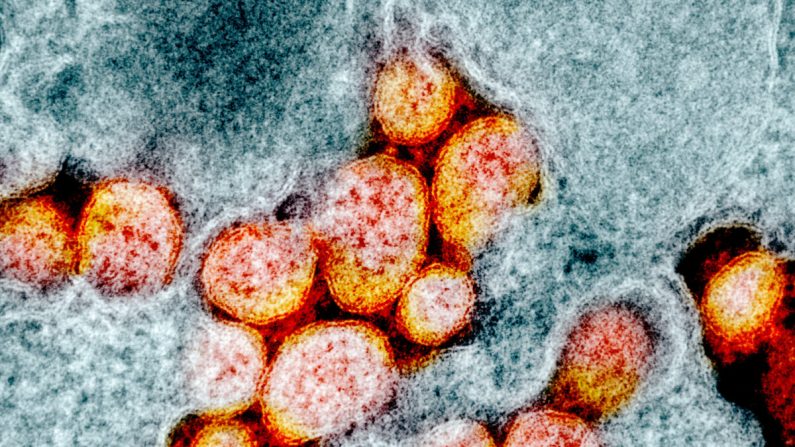 Micrografía de barrido electrónico que muestra partículas del virus SARS-CoV-2, también conocido como el virus del PCCh, de un paciente aislado. (NIAID)