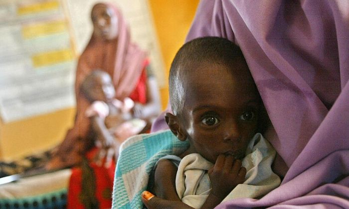 Una madre lava a su hijo desnutrido en el Hospital de Médicos sin Fronteras del campamento de refugiados de Dagahaley, que forma parte del gigantesco asentamiento de refugiados de Dadaab, el 22 de julio de 2011 en Dadaab (Kenya). (Oli Scarff/Getty Images)