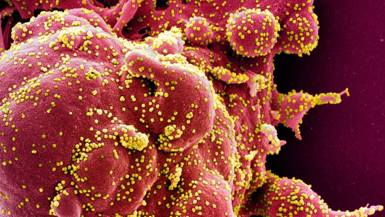 Microfotografía electrónica de exploración a color de una célula apoptótica (roja) muy infectada con partículas de virus PCCh (amarilla), aislada de una muestra de un paciente. Imagen capturada en la Instalación de Investigación Integrada del NIAID (IRF) en Fort Detrick, Maryland, publicada el 2 de abril de 2020. (NIAID)