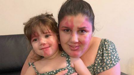 Madre pinta su cara con la marca de nacimiento de su niña: «Quería ser tan hermosa como ella»
