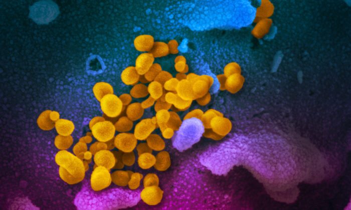Esta imagen de microscopio electrónico de barrido, publicada el 13 de febrero de 2020, muestra al SARS-CoV-2 (amarillo), también conocido como 2019-nCoV, el virus que causa COVID-19, aislado de un paciente en Estados Unidos, emergiendo de la superficie de las células (azul/rosa) cultivadas en el laboratorio. (NIAID-RML)