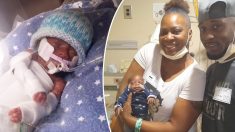 Bebé prematuro, más pequeño que una mano, sobrevive y finalmente deja el hospital para ir a casa