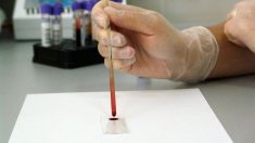 Investigadores de San Diego dicen que nueva prueba de sangre detecta cáncer 4 años antes de aparecer