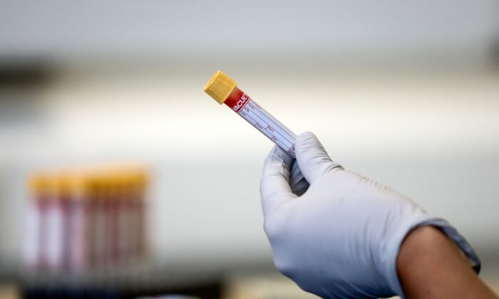 Un paramédico sostiene un tubo de ensayo que contiene una muestra de sangre durante un programa de pruebas de anticuerpos en Birmingham, Gran Bretaña, el 5 de junio de 2020. (Simon Dawson/POOL/AFP/Getty Images)