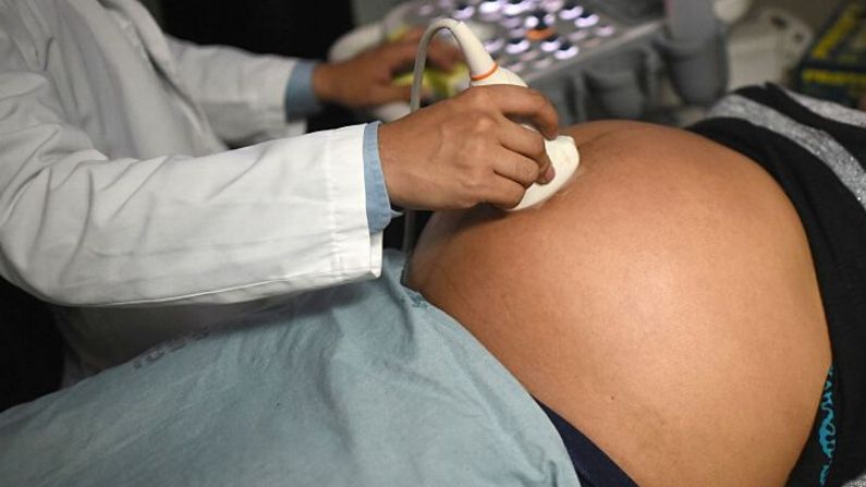 Una mujer embarazada se hace un ultrasonido en maternidad del Instituto Guatemalteco de Seguridad Social (IGSS) en la ciudad de Guatemala el 2 de febrero de 2016. (JOHAN ORDONEZ/AFP vía Getty Images)