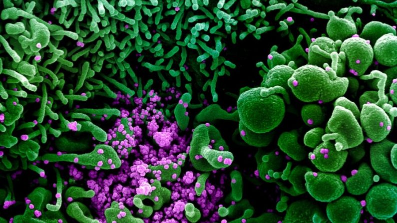 Microfotografía electrónica de escaneo a color de una célula (verde) muy infectada con partículas del virus del PCCh (púrpura), también conocido como SARS-CoV-2, aislada de una muestra de un paciente, foto publicada el 16 de marzo de 2020. (NIAID)