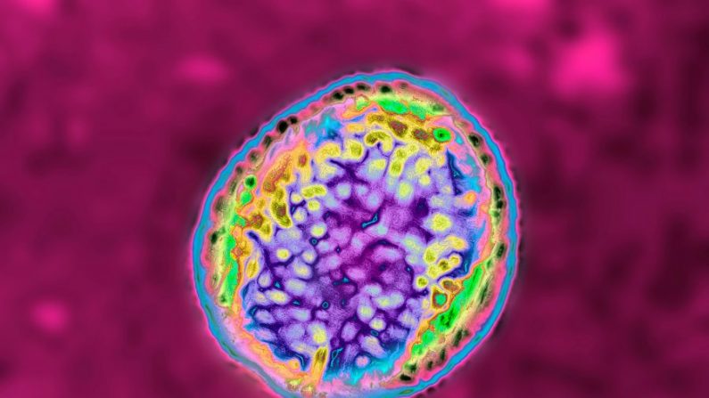 La bacteria brucela responsable de la brucelosis o fiebre de Malta (BSIP/Education Images/Universal Images Group via Getty Images)