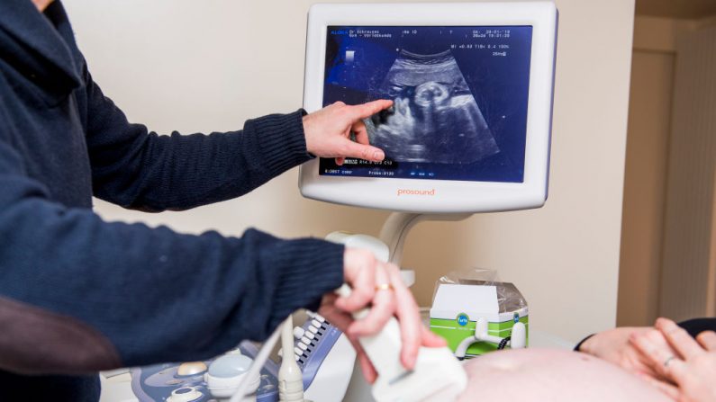 Médico realiza un examen de ultrasonido a mujer embarazada en Malinas, el jueves 31 de enero de 2019.  (JASPER JACOBS/AFP a través de Getty Images)