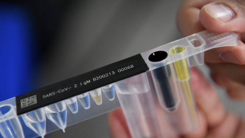 Un kit de prueba de anticuerpos contra el virus del PCCh en Sophonix, una empresa que produce kits de prueba para uso médico, en Beijing. (GREG BAKER/AFP a través de Getty Images)