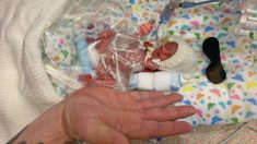 Bebé que nace más pequeña que la mano de su padre y 10% de probabilidad de sobrevivir se va a casa