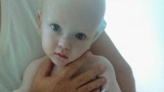 Bebé que sufrió abuso y «se parecía a un extraterrestre» prospera con una amorosa familia adoptiva