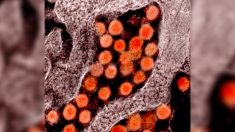 El virus del PCCh podría causar sordera permanente, según advertencia de investigadores británicos