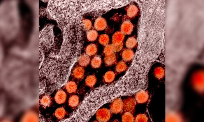 Micrografía electrónica de transmisión de partículas del virus del PCCh, o virus SARS-CoV-2, aislado de un paciente. (NIAID/CC BY 2.0)