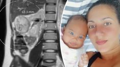 Madre atribuye a su bebé haberle salvado la vida después que médicos detectaran un tumor en el embarazo
