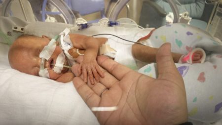 Bebé que nació 4 meses antes de tiempo finalmente se va a casa después de 1 año en la UCIN