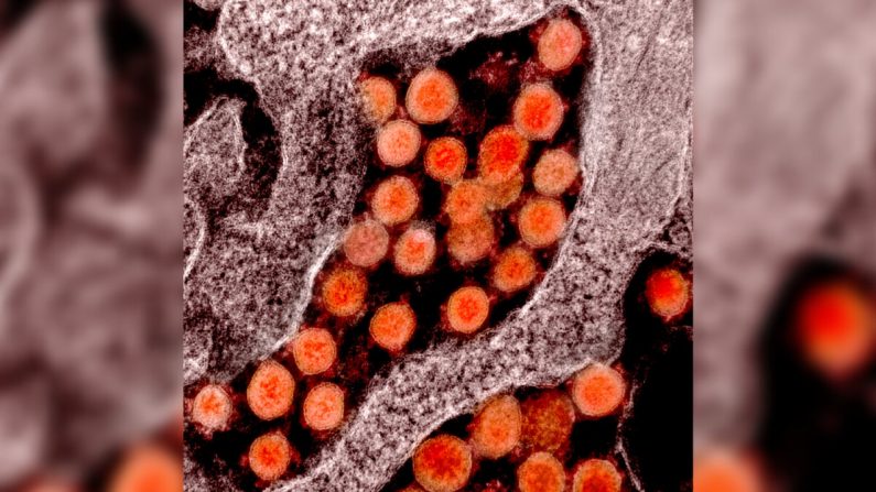 Micrografía electrónica de transmisión de partículas del virus del PCCh, o virus SARS-CoV-2, aislado de un paciente. (NIAID)