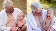 Abuelo y nieto con síndrome de Down muestran sus cicatrices el aniversario de su cirugía del corazón