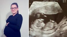 Mujer embarazada lleva bebé muerta durante 10 semanas para dar a la gemela oportunidad de sobrevivir