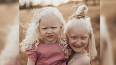 Mujer con dos hijas albinas habla de sus miedos iniciales hasta el desarrollo de su espíritu de lucha