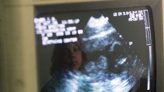 Ley de Indiana exige que las madres se hagan un ultrasonido antes de un aborto a partir del 1 de enero