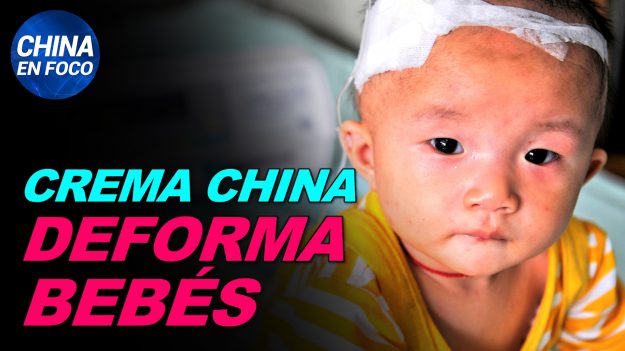 China en Foco: Producto chino causa deformidades en bebés. Aparecen secuelas en casi todos los pacientes del virus