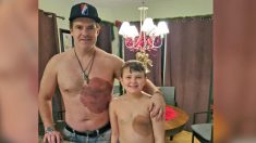 Hombre sorprende a su hijo con tatuaje igual a marca de nacimiento para aumentar su confianza