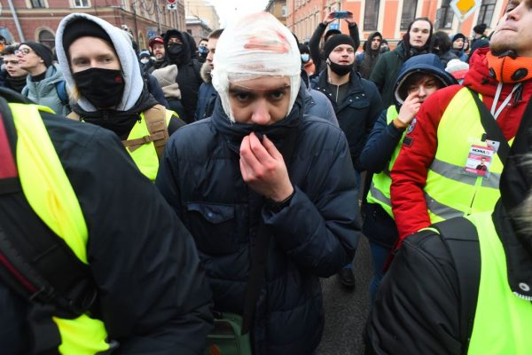 Un hombre herido es visto durante una manifestación en apoyo del líder de la oposición encarcelado Alexei Navalny en San Petersburgo, Rusia, el 31 de enero de 2021. (Foto de Olga Maltseva / AFP a través de Getty Images)