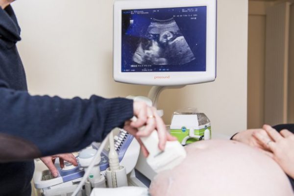 En una foto de ilustración, un médico realiza una ecografía a una mujer embarazada durante su visita ginecológica. (Jennifer Jacobs/AFP/Getty Images)