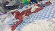 Nace»bebé milagro» a las 23 semanas cuando mamá pensaba que sufriría un aborto espontáneo