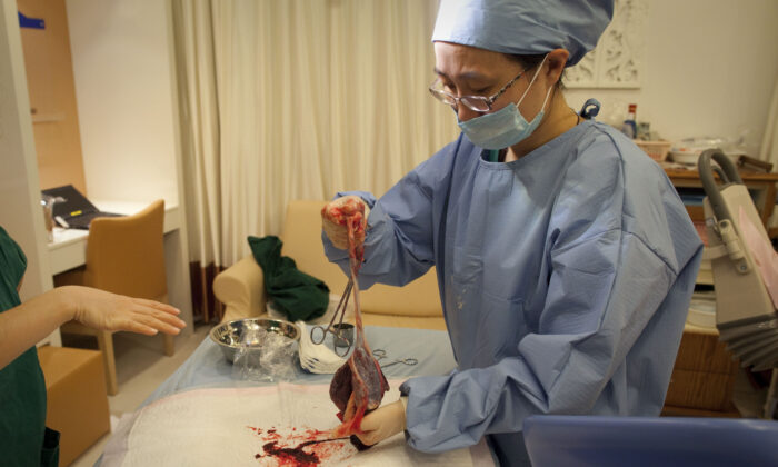 Una médica sostiene una placenta en la sala de partos de un hospital de Beijing (China) el 20 de febrero de 2012. (Ed Jones/AFP/GettyImages)