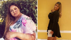 Mujer se somete a una drástica transformación cuando médicos advierten que morirá si no pierde peso