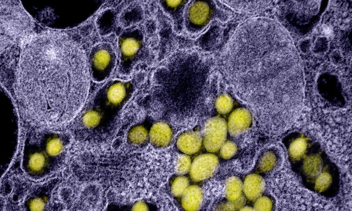 Micrografía electrónica de transmisión de partículas del virus del SARS-CoV-2, aisladas de un paciente. (NIAID)