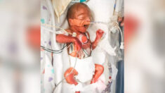 Bebé que nació del tamaño de un Sharpie desafía la probabilidad de sobrevivir, y ahora tiene 4 meses
