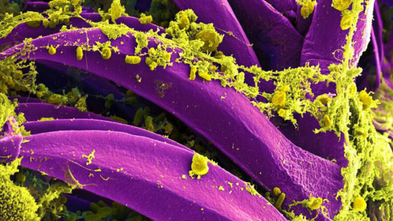 Esta imagen digitalmente coloreada de un microscopio electrónico de barrido (SEM) muestra una serie de bacterias Yersinia pestis de color amarillo, que se habían reunido en las espinas proventriculares de una pulga Xenopsylla cheopis. (Cortesía del Instituto Nacional de Alergias y Enfermedades Infecciosas)