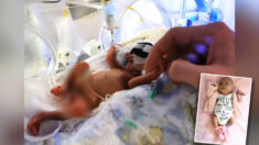 Bebé prematuro considerado uno de los más pequeños en sobrevivir en Escocia se va a casa
