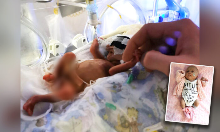 La bebé Sofia Viktoria Birina pesó apenas 1.1 libras al nacer y le dieron un 10 por ciento de probabilidad de sobrevivir durante el parto. (Cortesía de Inars Birina)