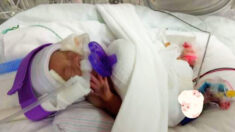 El bebé «más ligero del mundo», sale del hospital después de 13 meses : ¡Pesaba igual que una manzana!