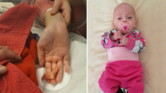 Bebé de poco más de 1 kg sobrevive milagrosamente, sus pies medían la mitad de un dedo de su madre