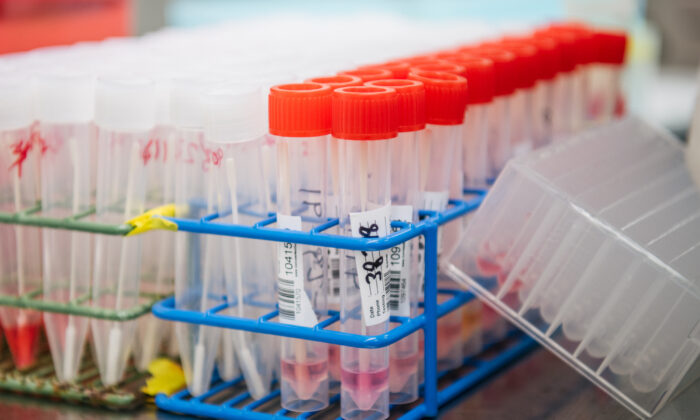 Muestras de COVID-19 en el laboratorio de pruebas en Houston, Texas, el 13 de agosto de 2021. (Brandon Bell/Getty Images)