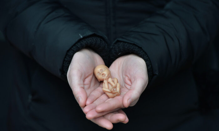 Un activista provida muestra un muñeco de plástico que representa un feto de 12 semanas mientras se encuentra fuera de la clínica Marie Stopes en Belfast, Irlanda del Norte, el 7 de abril de 2016. (Charles McQuillan/Getty Images)