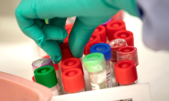 Un científico del laboratorio médico analiza viales de muestras para detectar el virus del PCCh en el laboratorio de virología de la Universidad de Medicina de Washington en Seattle (Washington) el 13 de marzo de 2020. (John Moore/Getty Images)