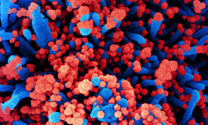 Micrografía electrónica de barrido sin fechar de una célula (azul) fuertemente infectada con partículas del virus del PCCh -también conocido como SARS-CoV-2, el nuevo coronavirus- (rojo), aislada de una muestra de un paciente en la Instalación de Investigación Integrada (IRF) del NIAID en Fort Detrick, Maryland, el 31 de octubre de 2020. (NIAID)
