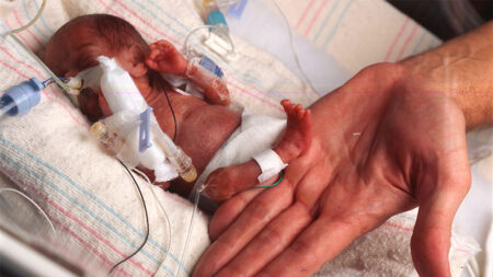 Bebé micro prematuro de 1libra desafía probabilidad de vida: «Milagroso»
