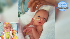 Nace bebé con 13 semanas de anticipación, tan pequeña para usar ropa de muñecas: ¡Es una guerrera!